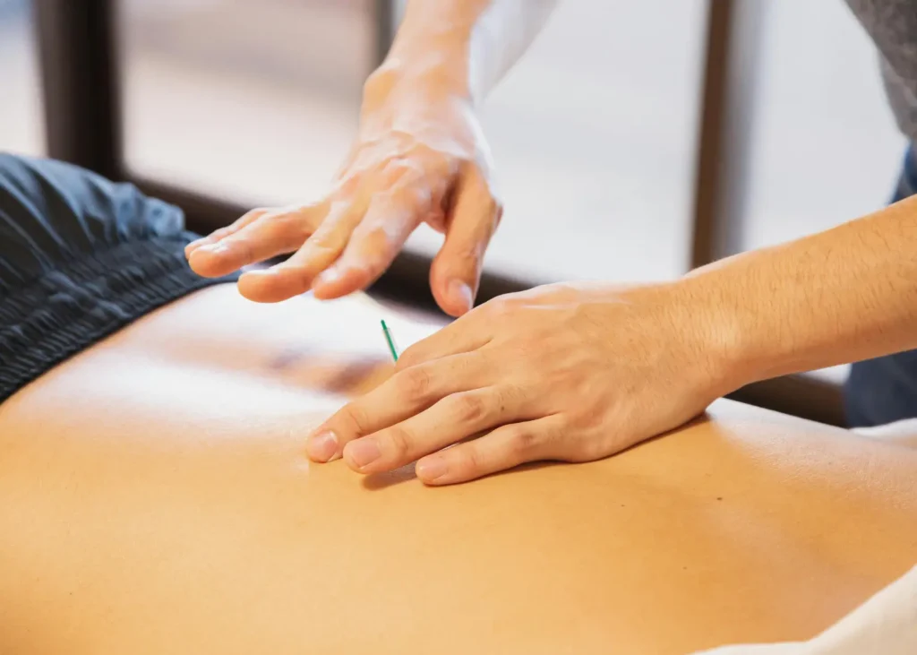 Hands applying trigger point massage with an acupuncture needle inserted into the lower back