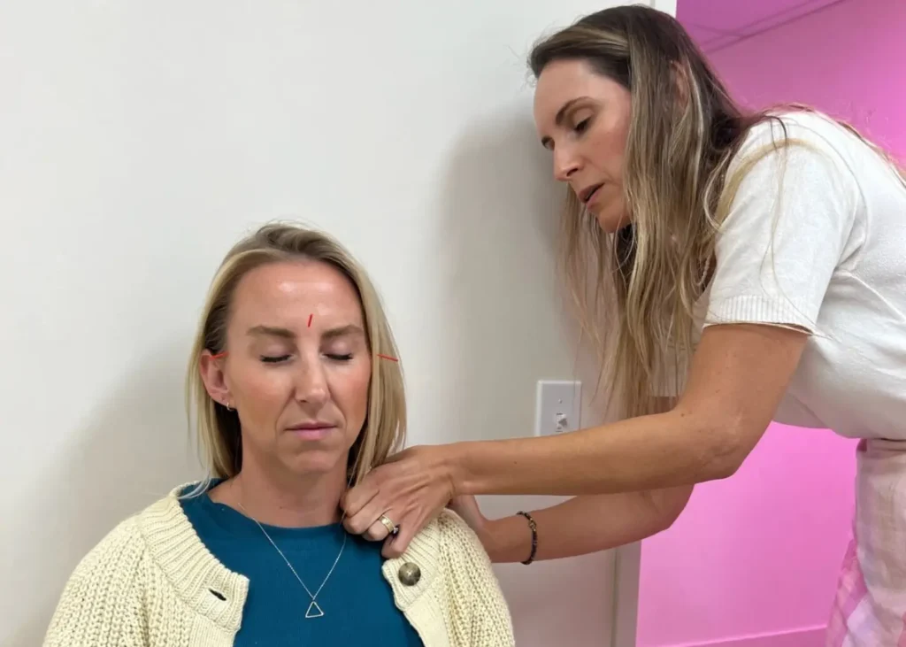 Integrative pain therapy session with a practitioner applying acupuncture needles while massaging the patient’s shoulder.