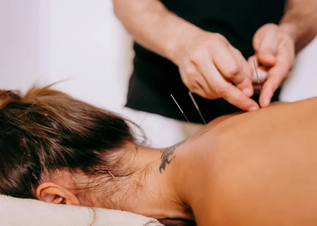 Practitioner performing trigger point acupuncture on a woman's neck and upper back muscles