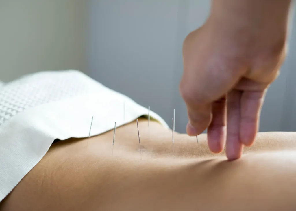 Acupuncture Meridian System