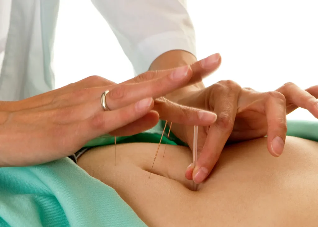 Preventive medicine through acupuncture demonstrated by a practitioner inserting needles into a patient’s abdominal area